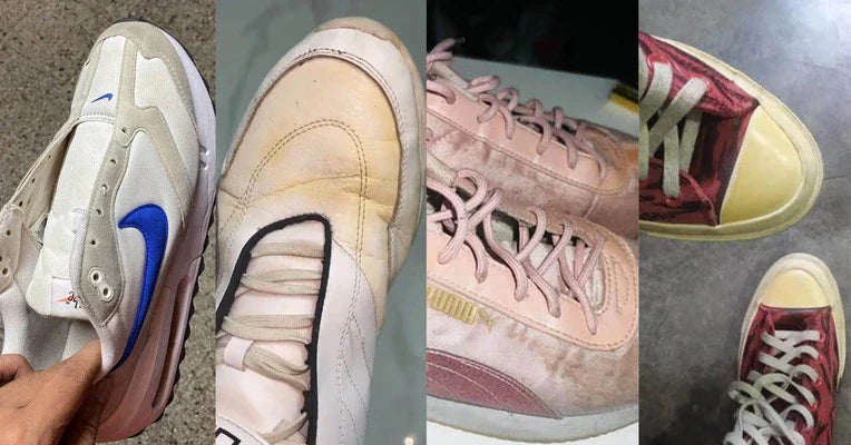Detergent Killed My Shoes